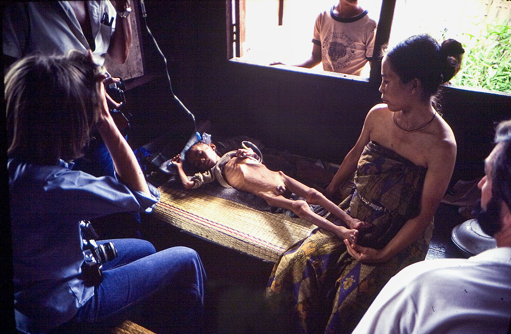 Starving child, Thai refugee camp, 1979.